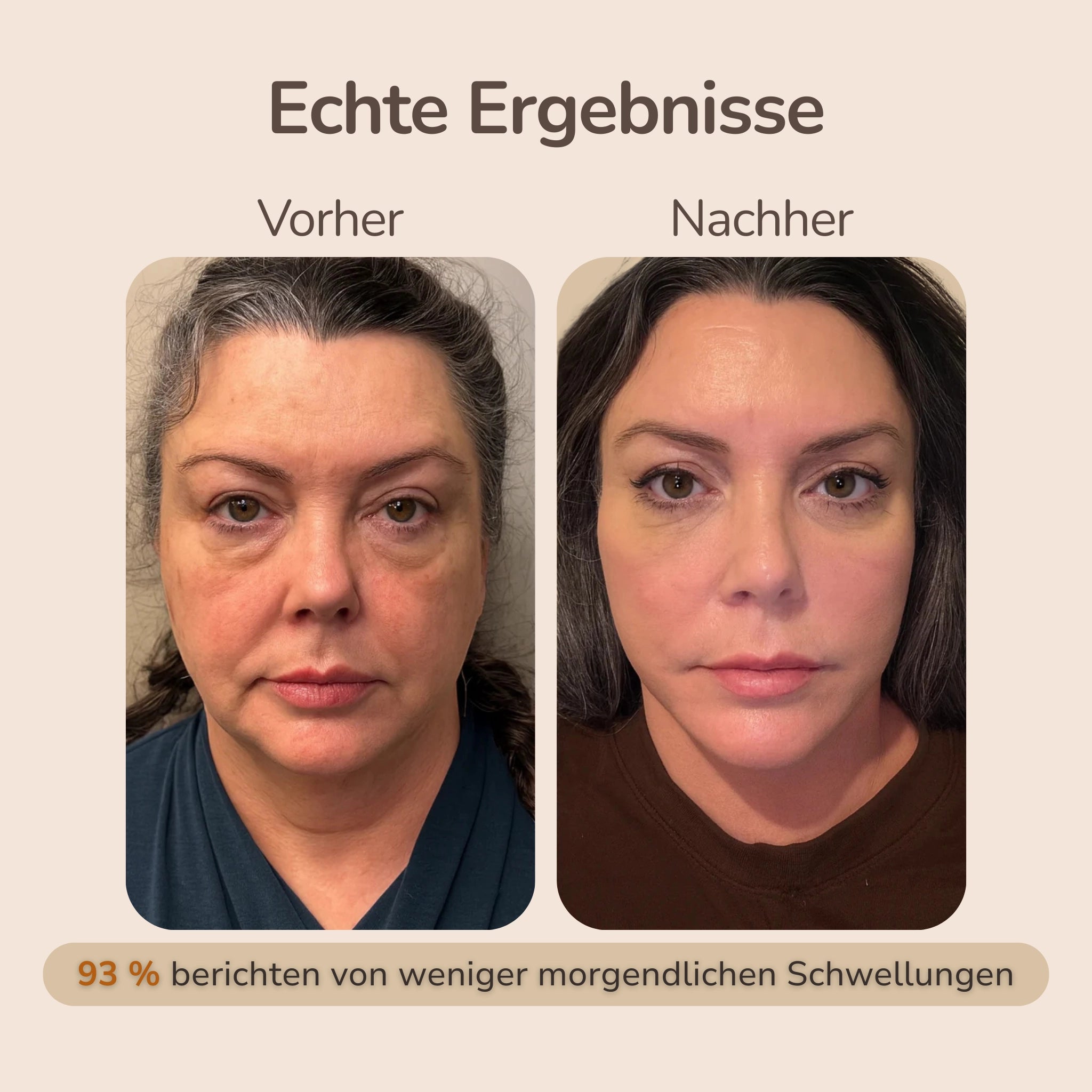 SculptLift™ - Lymphdrainagen Bürste